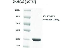 Recombinant SMARCA2 / BRM (1367-1511), GST-tag protein gel.