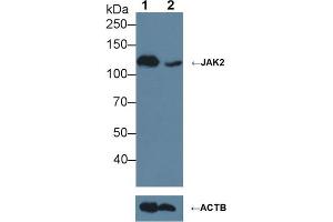 Knockout Varification: ;Lane 1: Wild-type Jurkat cell lysate; ;Lane 2: JAK2 knockout Jurkat cell lysate; ;Predicted MW: 130kDa ;Observed MW: 130kDa;Primary Ab: 3µg/ml Rabbit Anti-Human JAK2 Antibody;Second Ab: 0.