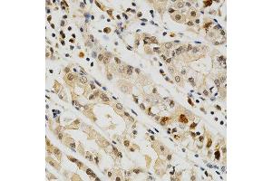 Immunohistochemistry of paraffin-embedded human stomach using CD274 antibody at dilution of 1:200 (x400 lens) (PD-L1 antibody)