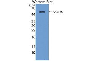 Detection of Recombinant CK14, Mouse using Polyclonal Antibody to Cytokeratin 14 (CK14) (KRT14 antibody  (AA 1-484))
