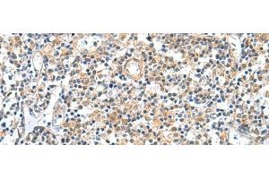 Immunohistochemistry of paraffin-embedded Human tonsil tissue using GEMIN7 Polyclonal Antibody at dilution of 1:50(x200)