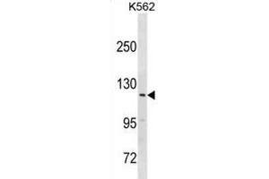 Western Blotting (WB) image for anti-Hect Domain and RLD 3 (HERC3) antibody (ABIN3000995)