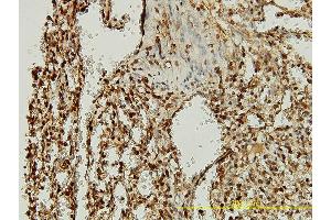 Immunoperoxidase of monoclonal antibody to ORC2L on formalin-fixed paraffin-embedded human spleen tissue. (ORC2 antibody  (AA 1-577))