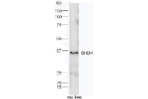 Mouse liver lysates probed with Rabbit Anti-DHDH Polyclonal Antibody, Unconjugated (ABIN2559590) at 1:300 overnight at 4˚C. (DHDH antibody  (AA 281-334))