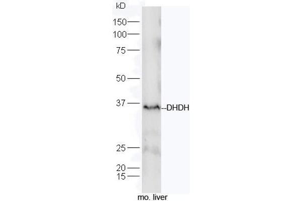 DHDH antibody  (AA 281-334)