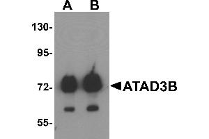 Western blot analysis of ATAD3B in human kidney tissue lysate with ATAD3B antibody at (A) 1 and (B) 2 µg/mL . (ATAD3B antibody  (C-Term))