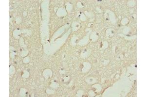 Immunohistochemistry of paraffin-embedded human brain tissue using ABIN7146436 at dilution of 1:100 (CAMK1D antibody  (AA 1-180))