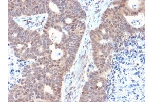 Immunohistochemistry (IHC) image for anti-Fas (TNFRSF6) Associated Factor 1 (FAF1) antibody (ABIN6939120)