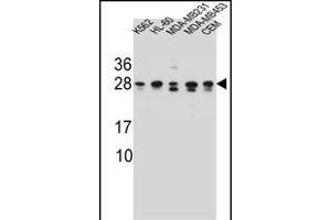 RAB3D Antibody (C-term) (ABIN657140 and ABIN2846278) western blot analysis in K562,HL-60,MDA-M,MDA-M,CEM cell line lysates (35 μg/lane).