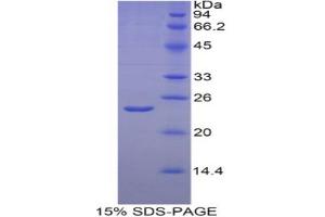 SDS-PAGE analysis of Human HIF2a Protein. (EPAS1 Protein)