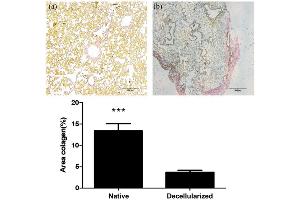 Immunohistochemistry (IHC) image for anti-COL1A2/COL1A1 antibody (ABIN5596819)
