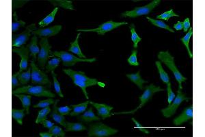 Immunofluorescence of monoclonal antibody to SF3B2 on HeLa cell.