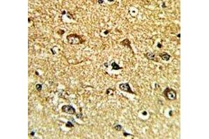 IHC analysis of FFPE human brain tissue with TH antibody (Tyrosine Hydroxylase antibody  (AA 486-514))