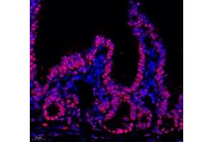 Immunofluorescent analysis of paraformaldehyde-fixed mouse ileum using HNRNPM (ABIN7074247) at dilution of 1: 4000 (HnRNP M1-M4 antibody)