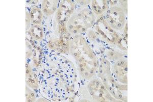 Immunohistochemistry of paraffin-embedded rat kidney using UBE3A antibody at dilution of 1:200 (40x lens).