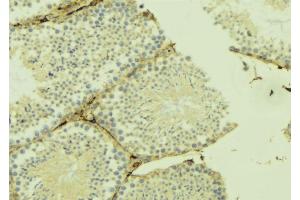 ABIN6274911 at 1/100 staining Mouse testis tissue by IHC-P. (B4GALT3 antibody  (Internal Region))