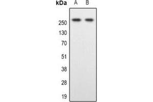 Western blot analysis of SPTBN1 expression in Hela (A), Colo205 (B) whole cell lysates. (SPTBN1 antibody)