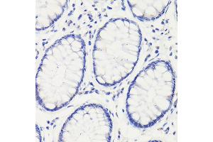 Immunohistochemistry of paraffin-embedded mouse stomach using GAPDH Mouse mAb (ABIN3020540, ABIN3020541, ABIN3020542 and ABIN1512934) at dilution of 1:100 (40x lens). (GAPDH antibody)