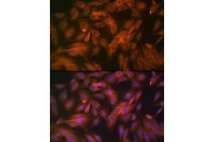 Immunofluorescence analysis of C6 cells using Calpain 1 Rabbit mAb (ABIN7266033) at dilution of 1:100 (40x lens). (CAPNL1 antibody)