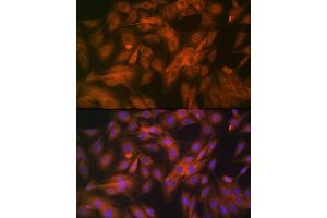 Immunofluorescence analysis of C6 cells using Calpain 1 Rabbit mAb (ABIN7266033) at dilution of 1:100 (40x lens).