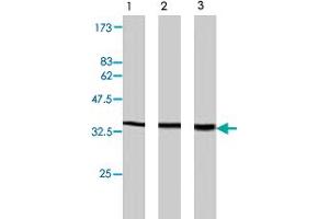 Western blot analysis of extract from PC-12 (lane 1) , NRK cells (lane 2) and Swiss3T3 cells (lane 3) , using Plscr2 polyclonal antibody  . (PLSCR2 antibody)