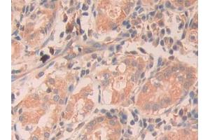 DAB staining on IHC-P; Samples: Human Stomach Tissue (RNASE11 antibody  (AA 18-199))