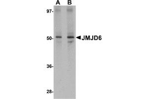 Western Blotting (WB) image for anti-Jumonji Domain Containing 6 (JMJD6) (N-Term) antibody (ABIN1031427) (JMJD6 antibody  (N-Term))