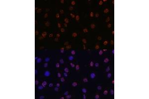Immunofluorescence analysis of C6 cells using DiMethyl-Histone H3-K14 pAb (ABIN7267679) at dilution of 1:100 (40x lens).