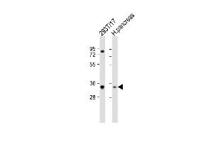 All lanes : Anti-SHOX Antibody (N-term) at 1:2000 dilution Lane 1: 293T/17 whole cell lysate Lane 2: human pancreas lysate Lysates/proteins at 20 μg per lane. (SHOX antibody  (N-Term))