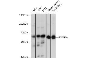 Western blot analysis of extracts of various cell lines, using TSEN54 Rabbit pAb (ABIN7271007) at 1:3000 dilution. (TSEN54 antibody  (AA 1-300))