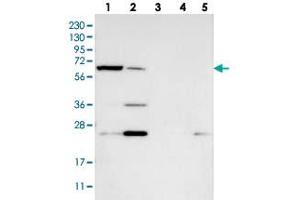Western blot analysis of Lane 1: RT-4, Lane 2: U-251 MG, Lane 3: Human Plasma, Lane 4: Liver, Lane 5: Tonsil with KLHDC10 polyclonal antibody  at 1:250-1:500 dilution. (KLHDC10 antibody)