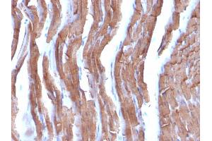 Formalin-fixed, paraffin-embedded Rat Heart stained with Muscle Specific Actin Mouse Monoclonal Antibody (MSA/953). (ACTA1/ACTA2A/ACTG2 antibody)