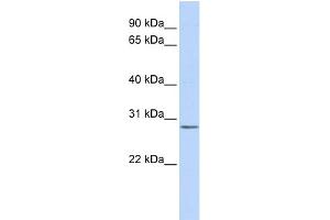 WB Suggested Anti-IMPA2 Antibody Titration: 0. (IMPA2 antibody  (Middle Region))