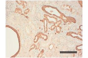 Image no. 1 for anti-Keratin Acidic (AE1) antibody (ABIN108613) (Keratin Acidic (AE1) antibody)