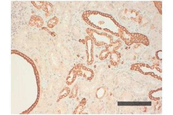 Keratin Acidic (AE1) antibody