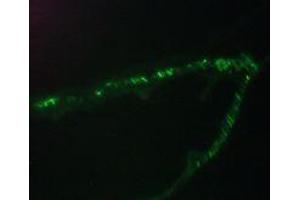 Immunofluorescence staining of a 7 days old zebrafish embryo (Desmin antibody)