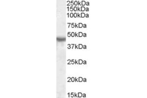 Western Blotting (WB) image for anti-Potassium Inwardly-Rectifying Channel, Subfamily J, Member 1 (KCNJ1) (Internal Region) antibody (ABIN2464210) (KCNJ1 antibody  (Internal Region))