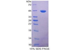 SDS-PAGE (SDS) image for Brain Natriuretic Peptide (BNP) (AA 18-106) protein (His tag,GST tag) (ABIN1098908)