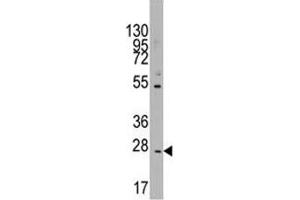 Western blot analysis of CD8B in K562 lysate