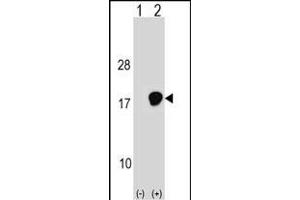 Western blot analysis of UBE2D3 (arrow) using rabbit polyclonal UBE2D3 Antibody (C-term) (ABIN1536647 and ABIN2848493). (UBE2D3 antibody  (C-Term))