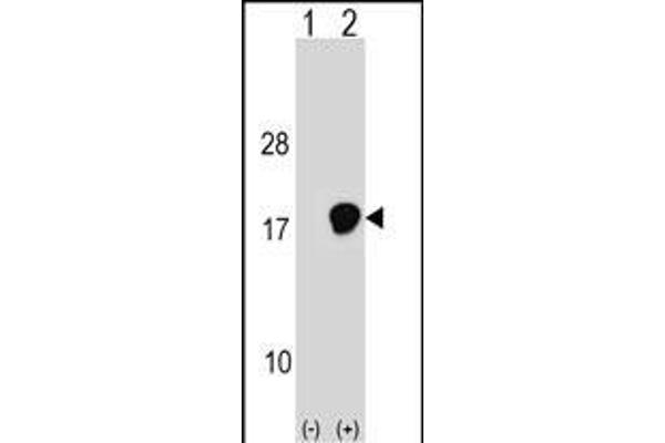 UBE2D3 antibody  (C-Term)