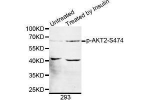 Western blot analysis of extracts of 293 cell line, using phospho-AKT2-S474 antibody. (AKT2 antibody  (pSer474))