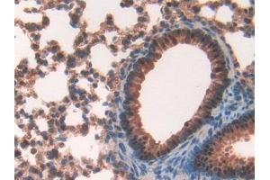 DAB staining on IHC-P; Samples: Mouse Lung Tissue (FKBP8 antibody  (AA 110-329))