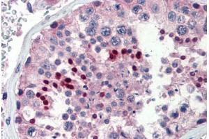 Immunohistochemistry (Paraffin-embedded Sections) (IHC (p)) image for anti-Nuclear Receptor Subfamily 0, Group B, Member 1 (NR0B1) (AA 359-408) antibody (ABIN462167)