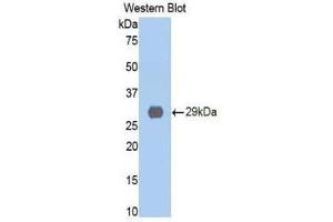 Western Blotting (WB) image for anti-Cathepsin D (CTSD) (AA 169-408) antibody (ABIN1858545) (Cathepsin D antibody  (AA 169-408))