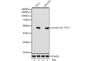 Western blot analysis of extracts of various cell lines, using Acetyl-p53- K370 antibody (ABIN7271082) at 1:1000 dilution. (p53 antibody  (acLys370))