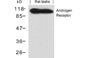 Image no. 1 for anti-Androgen Receptor (AR) (AA 648-652) antibody (ABIN401551) (Androgen Receptor antibody  (AA 648-652))