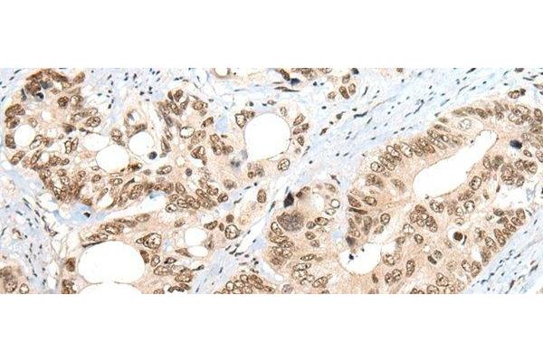 ZNF83 antibody