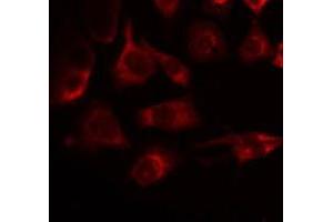 ABIN6275234 staining Hela by IF/ICC. (MRPS22 antibody  (C-Term))