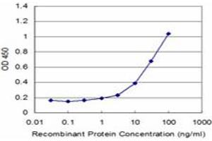 Detection limit for recombinant GST tagged STK24 is approximately 1ng/ml as a capture antibody. (STK24 antibody  (AA 1-431))